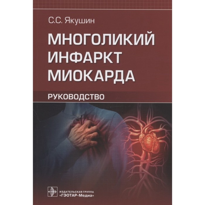 филоненко сергей павлович якушин сергей степанович боли в суставах дифференциальная диагностика Многоликий инфаркт миокарда: руководство. Якушин Сергей Степанович