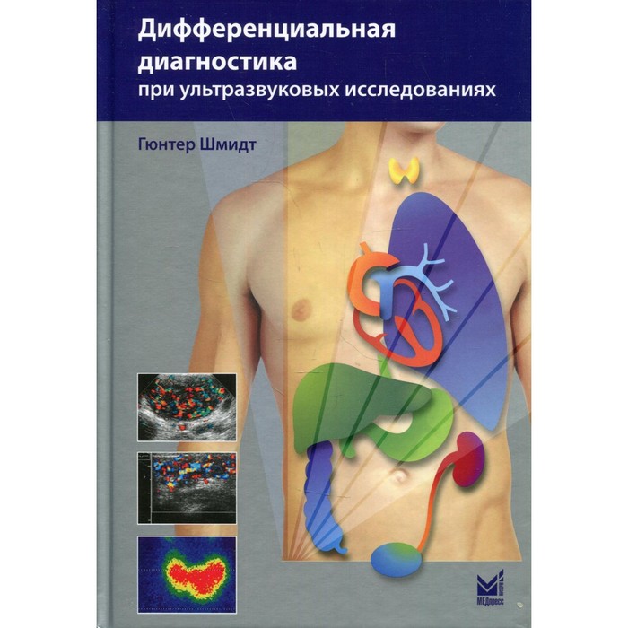 Дифференциальная диагностика при ультразвуковых исследованиях. 2-е издание. Гюнтер Шмидт шмидт г дифференциальная диагностика при ультразвуковых исследованиях