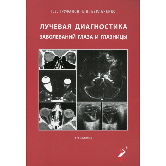 Лучевая диагностика заболеваний глаза и глазницы. 3-е издание. Труфанов Г.Е., Бурлаченко Е.П.