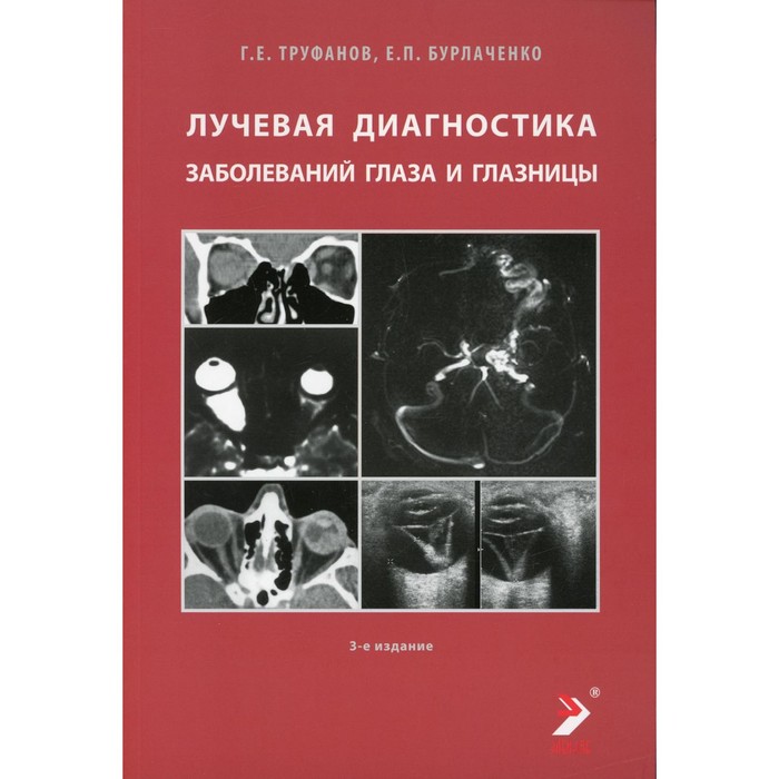 

Лучевая диагностика заболеваний глаза и глазницы. 3-е издание. Труфанов Г.Е., Бурлаченко Е.П.