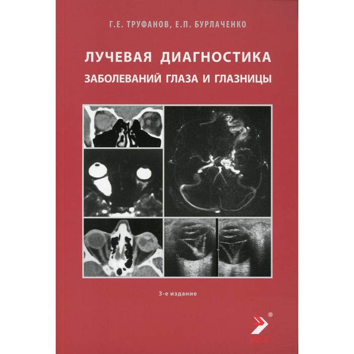 Лучевая диагностика заболеваний глаза и глазницы. 3-е издание. Труфанов Г.Е., Бурлаченко Е.П. лучевая диагностика повреждений голеностопного сустава и стопы 3 е издание труфанов г е пчелин и г менькова и с штенцель р э