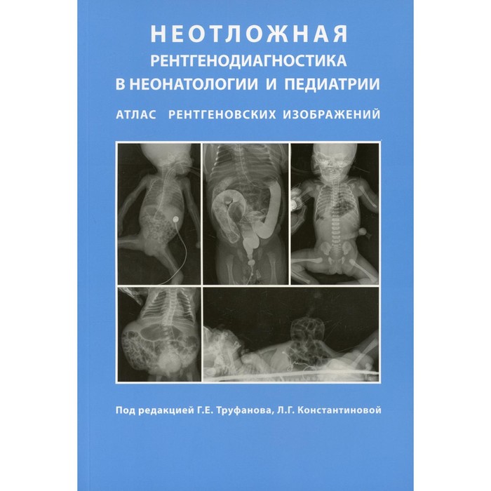

Неотложная рентгенодиагностика в неонатологии и педиатрии (атлас рентгеновских изображений). Под редакцией Труфанова Г.Е., Константиновой Л.Г.