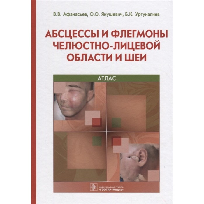 фото Абсцессы и флегмоны челюстно-лицевой области и шеи. афанасьев в. и др. гэотар-медиа
