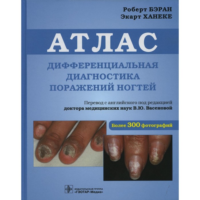 Дифференциальная диагностика поражений ногтей. Бэран Р., Ханеке Э. бэран р ханеке э атлас дифференциальная диагностика поражений ногтей