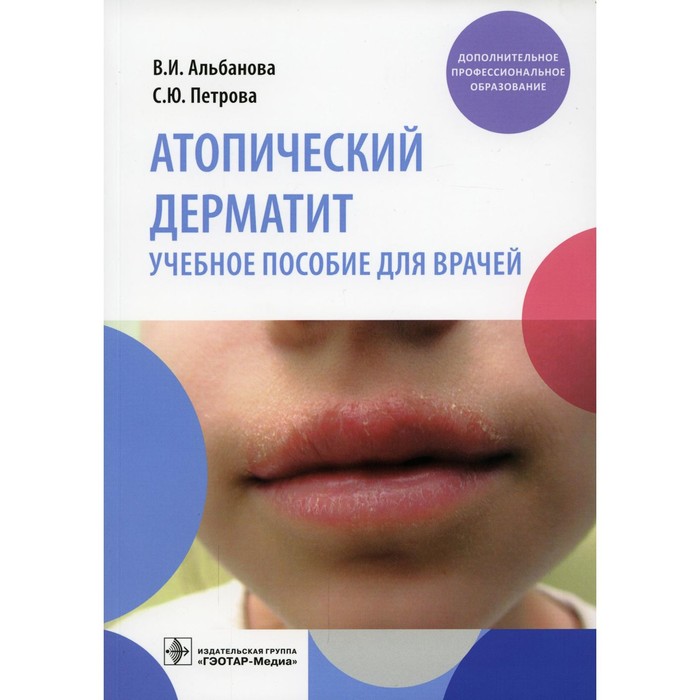 Атопический дерматит. Альбанова В.И. матушевская елена владиславовна свирщевская елена викторовна атопический дерматит генетика патогенез и терапия