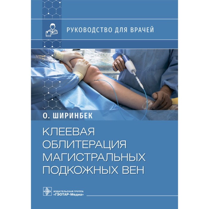 

Клеевая облитерация магистральных подкожных вен. Ширинбек О.