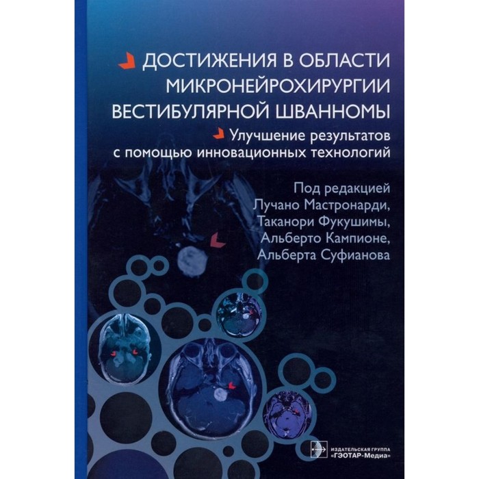 

Достижения в области микронейрохирургии вестибулярной шванномы