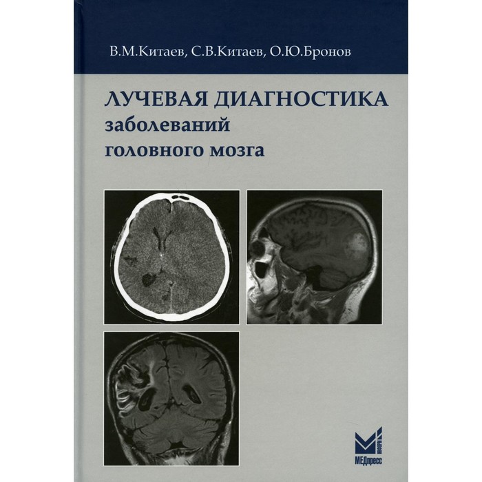 Лучевая диагностика заболеваний головного мозга. 3-е издание. Китаев В.М., Китаев С.В., Бронов О.Ю.