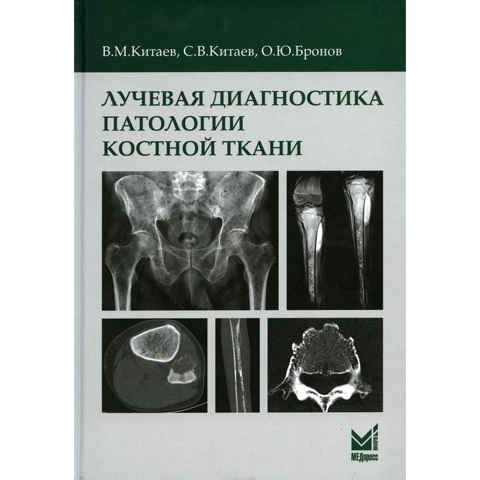 

Лучевая диагностика патологии костной ткани. Китаев В.М., Китаев С.В., Бронов О.Ю.