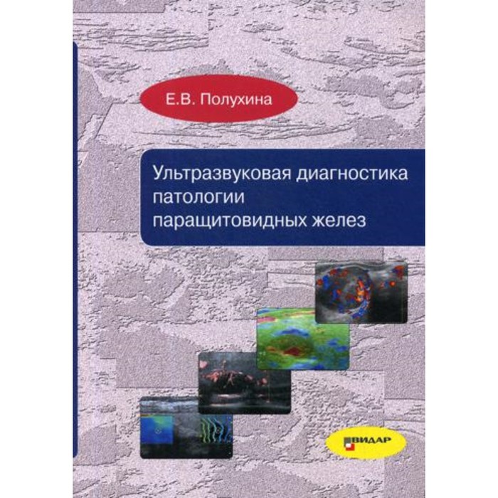 ультразвуковая диагностика патологии паращитовидных желез полухина е в Ультразвуковая диагностика патологии паращитовидных желез. Полухина Е.В.