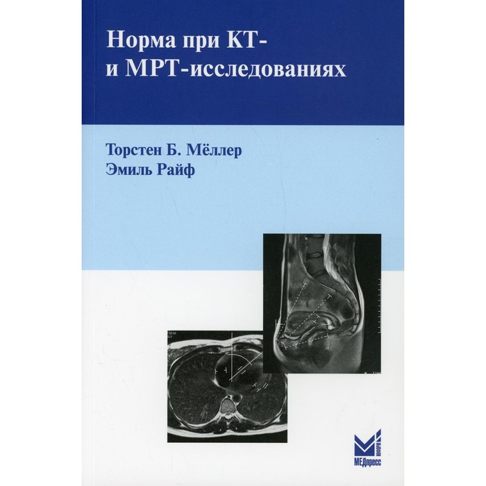 

Норма при КТ- и МРТ-исследованиях. Меллер Т.Б.