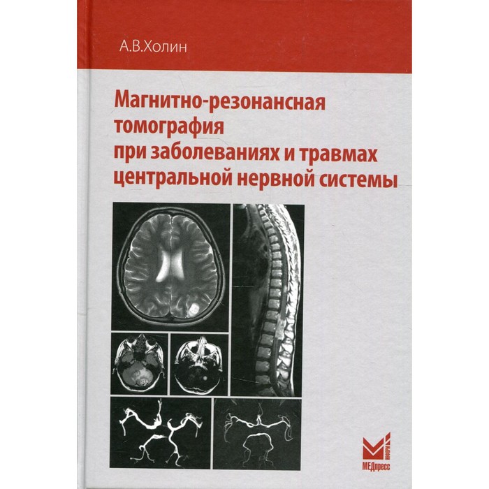 фото Магнитно-резонансная томография при заболеваниях и травмах центральной нервной системы. 2-е издание. холин а.в. медпресс-информ