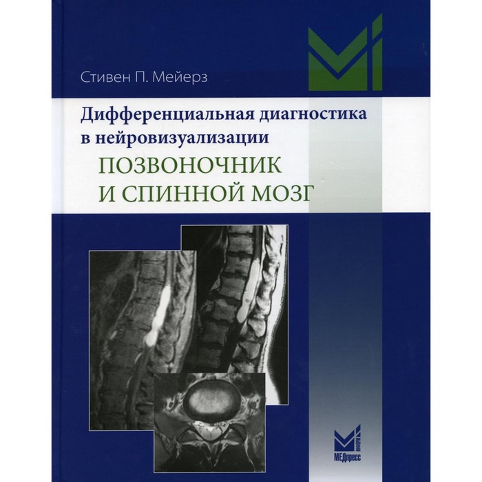 Дифференциальная диагностика в нейровизуализации. Позвоночник и спинной мозг. Мейерз С.П. мейерз с п дифференциальная диагностика в нейровизуализации позвоночник и спинной мозг