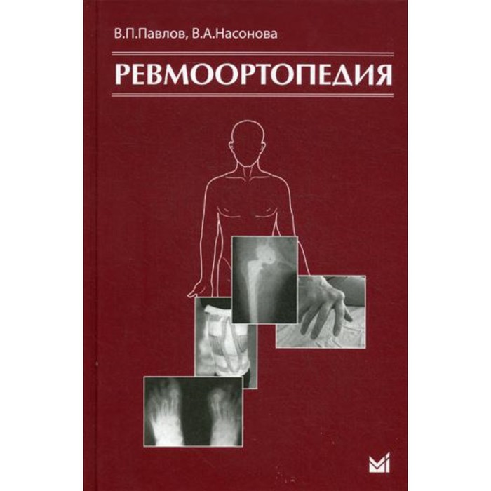 Ревмоортопедия. 3-е издание. Павлов В.П.