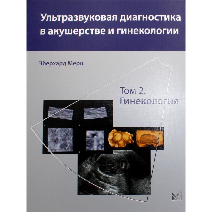 Ультразвуковая диагностика в акушерстве и гинекологии. В 2-х томах. Том 2. Гинекология. 2-е издание. Мерц Э. ультразвуковая диагностика в акушерстве и гинекологии в 2 х томах том 2 гинекология 2 е издание мерц э