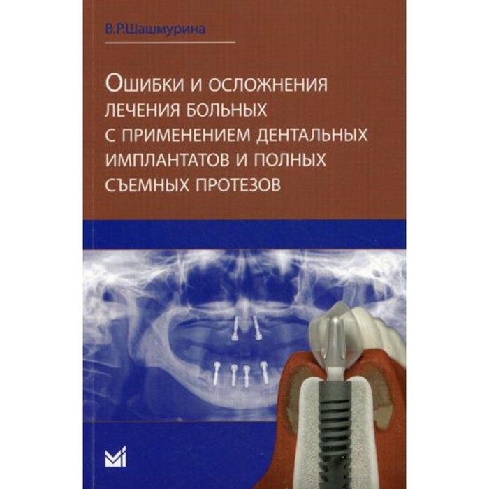 

Ошибки и осложнения лечения больных с применением дентальных имплантов и полных съемных протезов. Шашмурина В.Р.