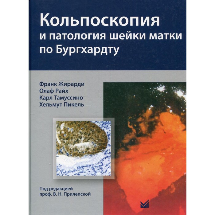 Кольпоскопия и патология шейки матки по Бургхардту. Жирарди Ф.