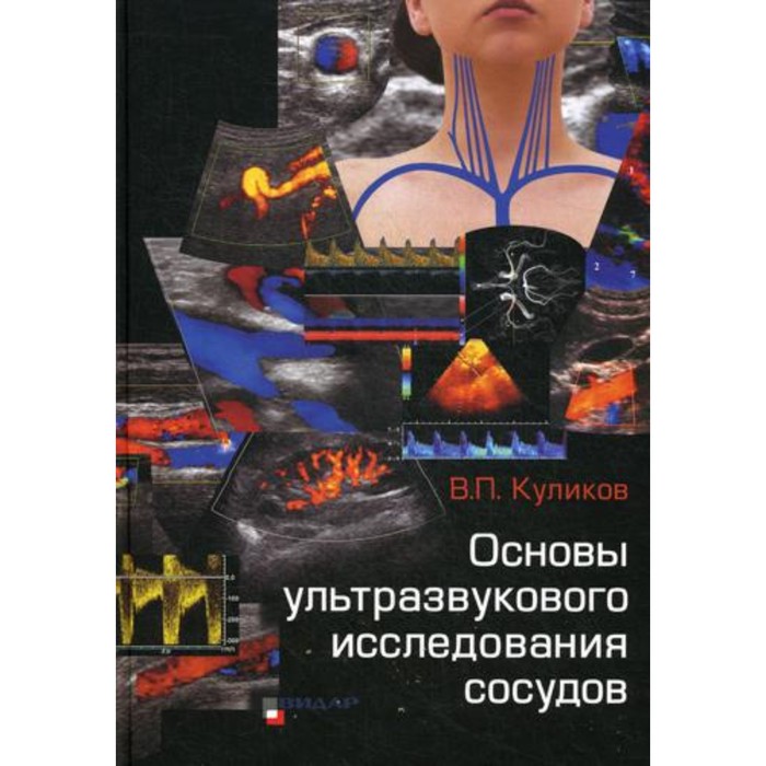 Основы ультразвукового исследования сосудов. Куликов В.П.