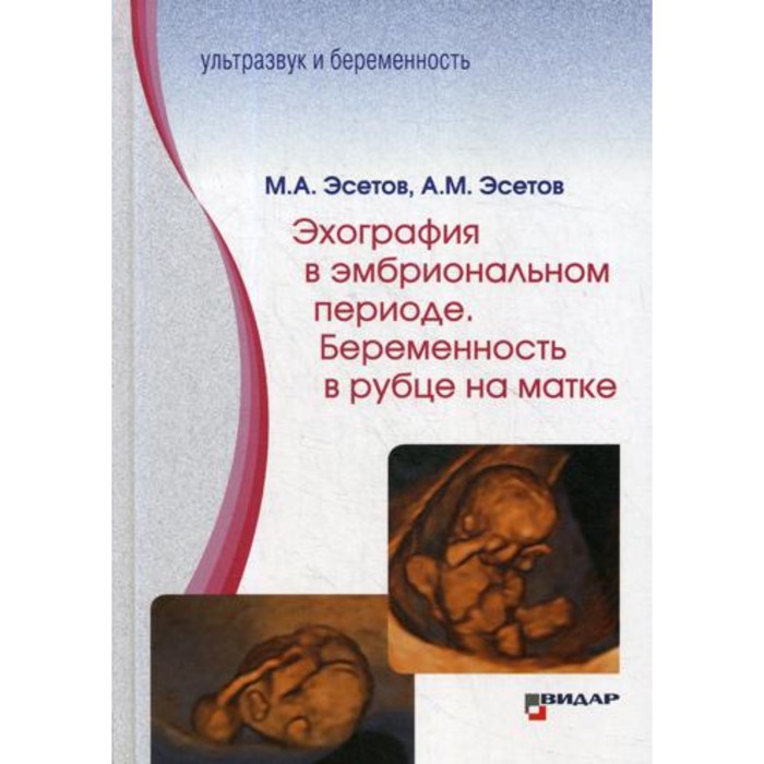 

Эхография в эмбриональном периоде. Беременность в рубце на матке. Эсетов М.А.