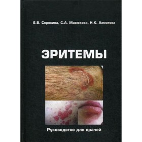 

Эритемы. Сорокина Е.В., Масюкова С.А., Ахматова Н.К.