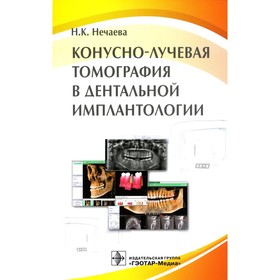 

Конусно-лучевая томография в дентальной имплантологии. Нечаева Н.К.