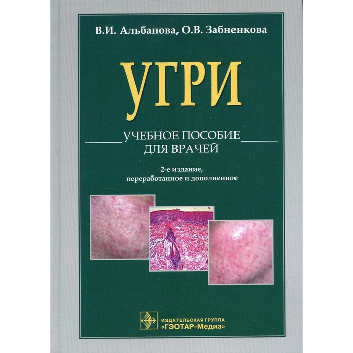 

L70. Угри. 2-е издание, переработанное и дополненное. Альбанова В.И.