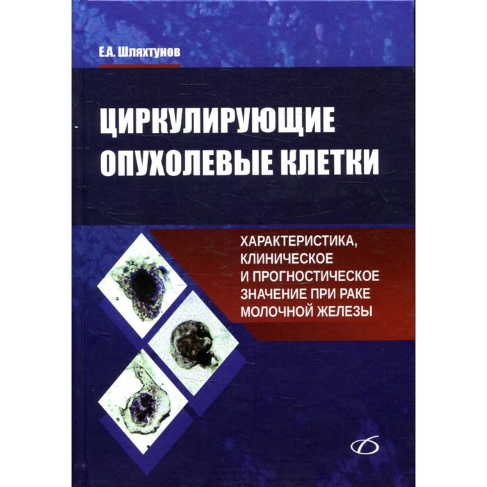 

Циркулирующие опухолевые клетки: характеристика, клиническое и прогностическое значение при раке молочной железы. Шляхтунов Е.А.