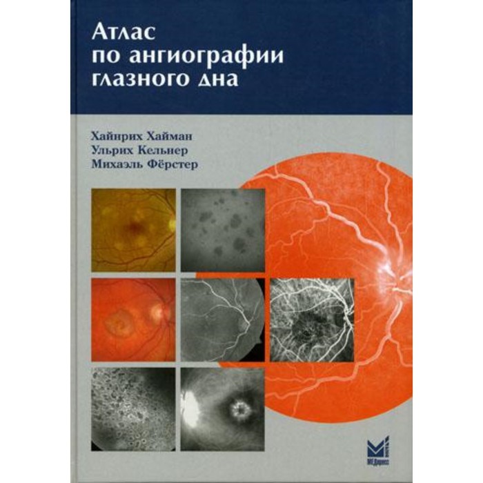 фото Атлас по ангиографии глазного дна. хайман х., астахова ю.с., лисочкиной а.б. медпресс-информ