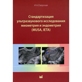 

Стандартизация ультразвукового исследования миометрия и эндометрия (MUSA, IETA). Озерская И.А.
