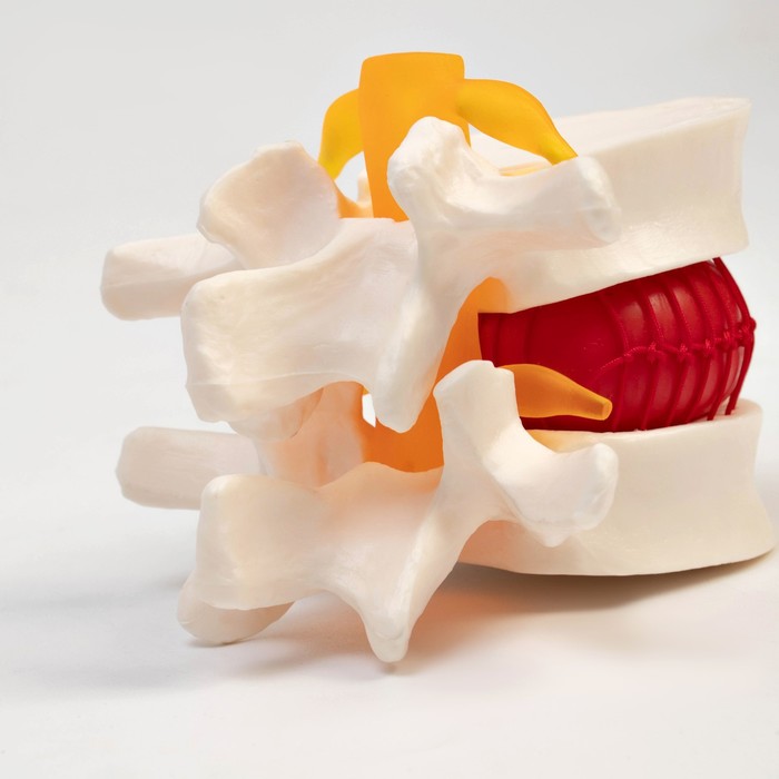 Макет "Межпозвоночный диск" 11*10*8см