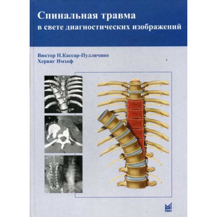 

Спинальная травма в свете диагностических изображений. Кассар-Пулличино В.Н., Имхоф Х.