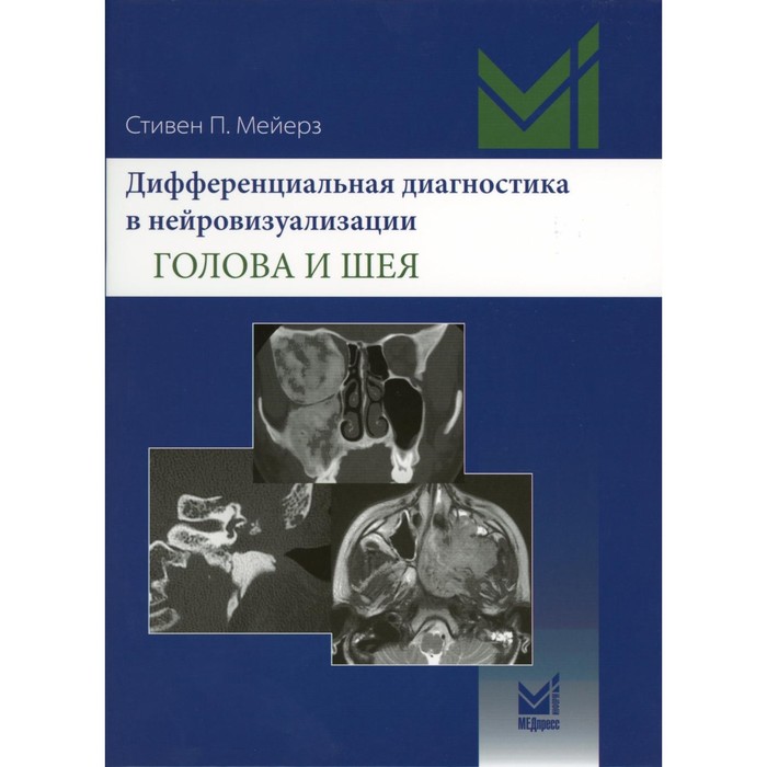 Дифференциальная диагностика в нейровизуализации. Голова и шея. Мейерз С.П. кох б л лучевая диагностика голова и шея