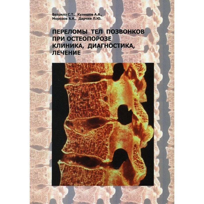 Переломы тел позвонков при остеопорозе. Клиника, диагностика, лечение. Ветрилэ С.Т., Кулешов А.А., Морозов А.К. морозов в яковлев а заболевания зрительного пути клиника диагностика лечение морозов в яковлев а бином пресс