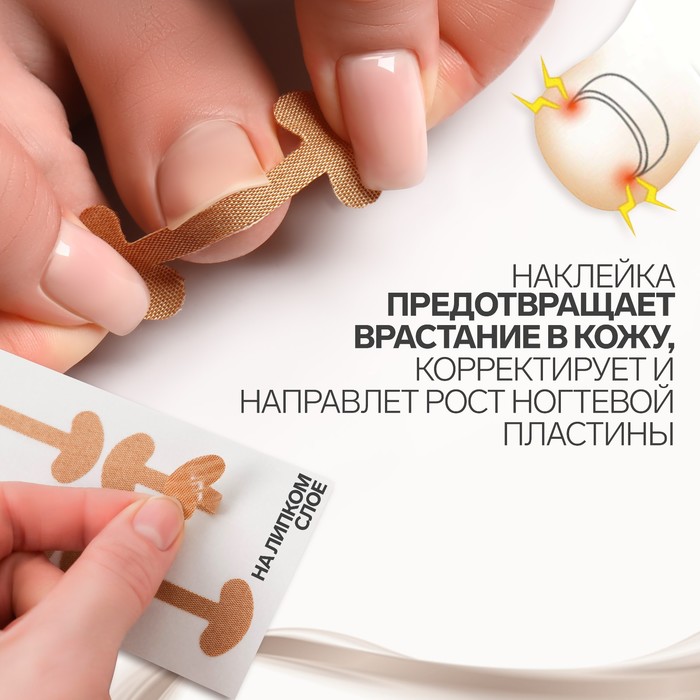 Набор наклеек для коррекции вросших ногтей, 8 шт, 5,2 × 2 см, цвет бежевый