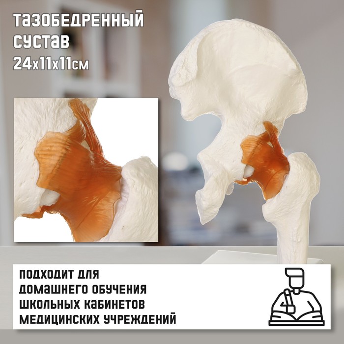 Макет Тазобедренный сустав 24*11*11см машина инерц стройка 2 цвета в пак 24 11 11см 3 358 7 120шт