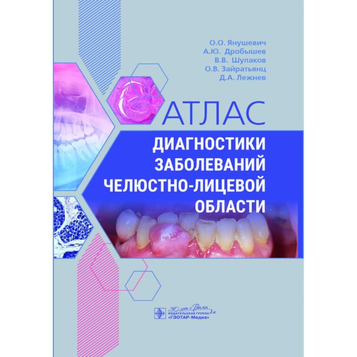 

Атлас диагностики заболеваний челюстно-лицевой области. Дробышев А.Ю., Янушевич О.О., Шулаков В.В.