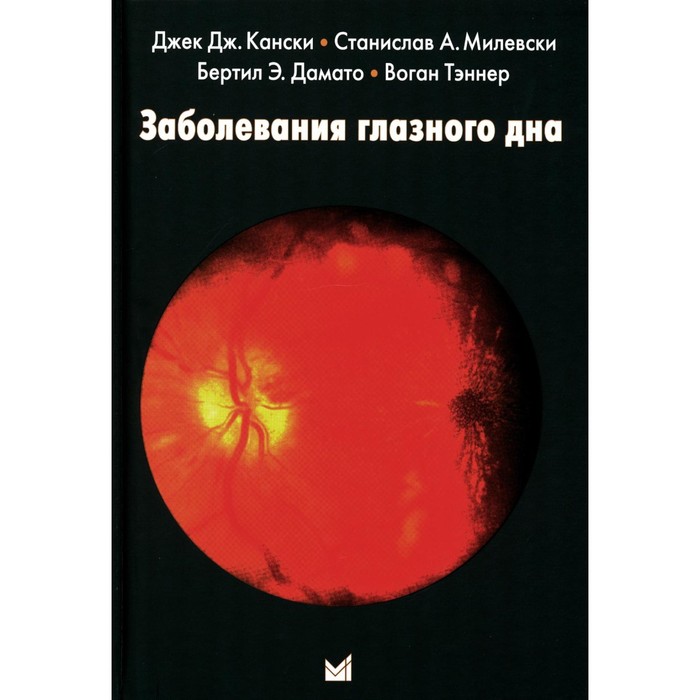 

Заболевания глазного дна. 3-е издание. Кански Дж.Д., Милевски С.А., Дамато Б.Э., Тэннер В.