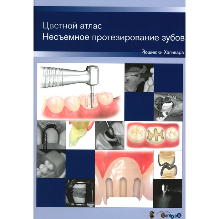 Несъемное протезирование зубов. Цветной атлас. Хагивара Й. несъемное протезирование технология изготовления стальной штампованной коронки учебно методическое пособие