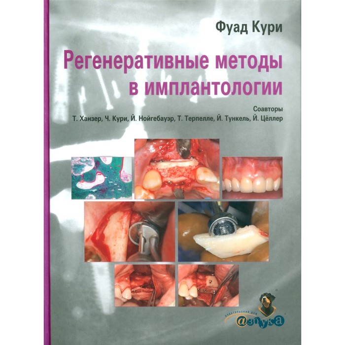 

Регенеративные методы в имплантологии. Кури Ф.