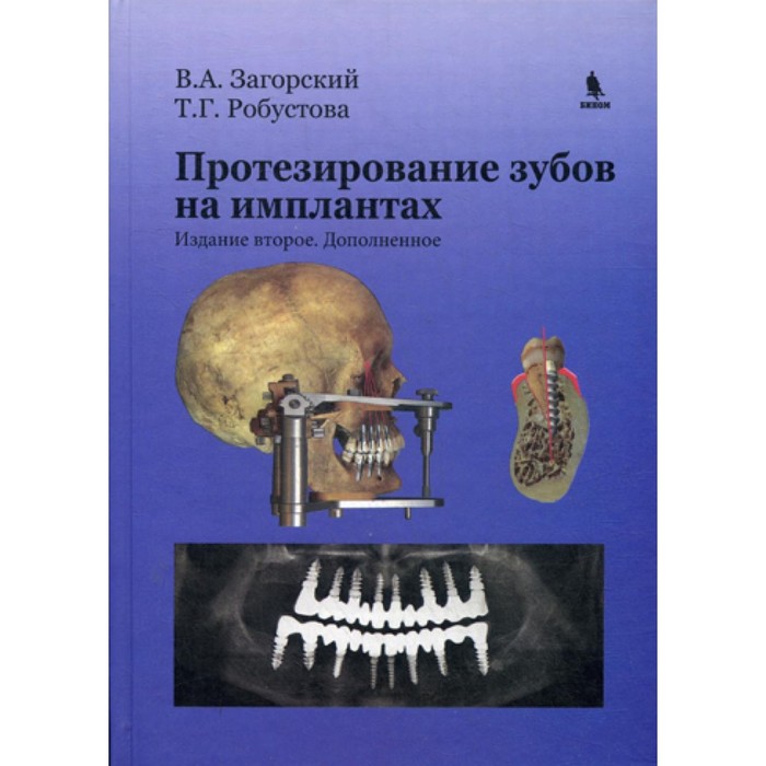 

Протезирование зубов на имплантатах. 2-е издание, дополненное. Робустова Т.Г., Загорский В.А.