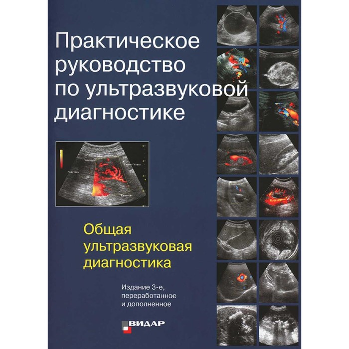 Практическое руководство по ультразвуковой диагностике. Общая ультразвуковая диагностика. 3-е издание, переработанное и дополненное. Под ред. Митькова В.В. ультразвуковая диагностика 3 е издание переработанное и дополненное хофер м