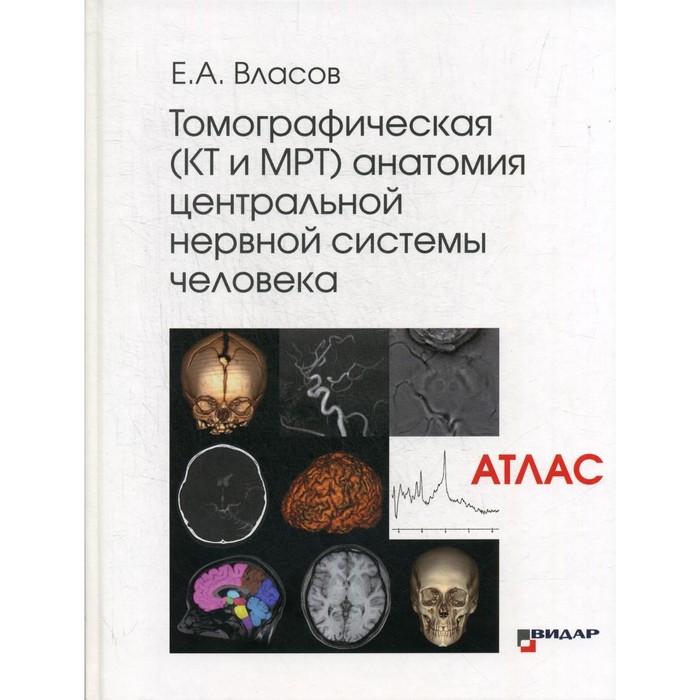 Томографическая (КТ и МРТ) анатомия центральной нервной системы человека. Атлас. Власов Е.А.