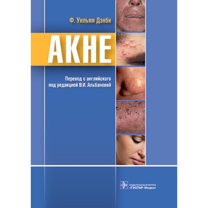 

Акне. Дэнби У.Ф.