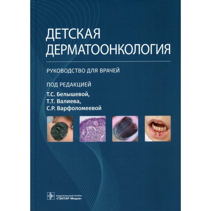 

Детская дерматоонкология. Руководство для врачей. Варфоломеева С.Р., Белышева Т.С., Валиев Т.Т.