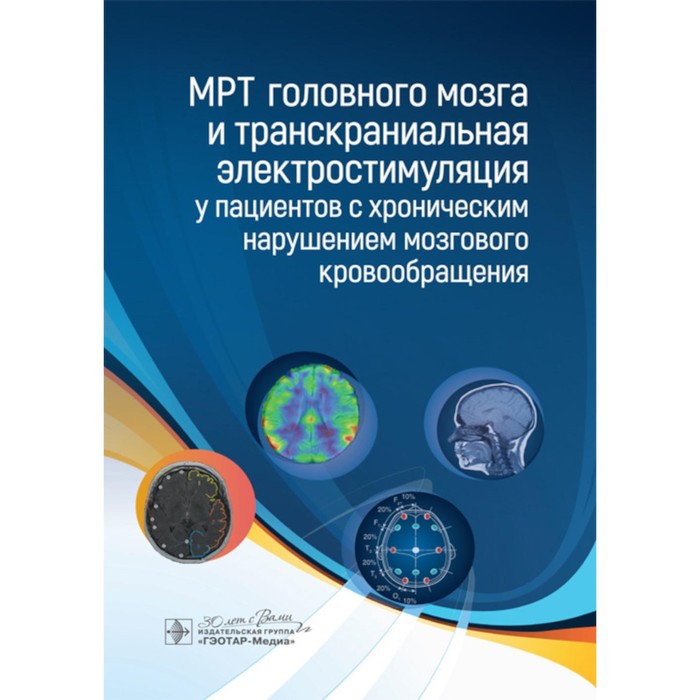 

МРТ головного мозга и транскраниальная электростимуляция у пациентов с хроническим нарушением мозгового кровообращения. Борсуков А.В., Морозова Т.Г.