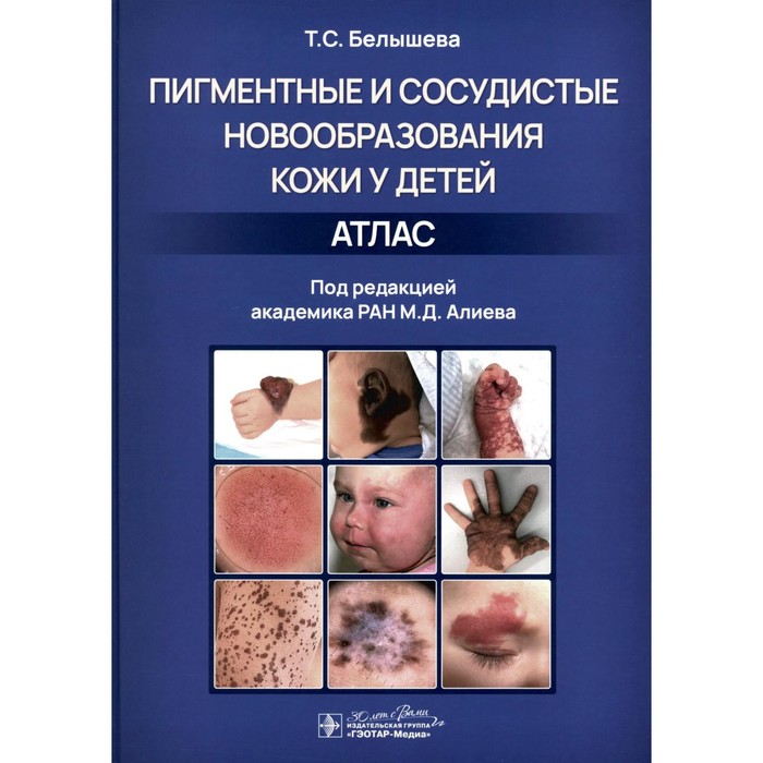 

Пигментные и сосудистые новообразования кожи у детей. Атлас. Белышева Т.С.