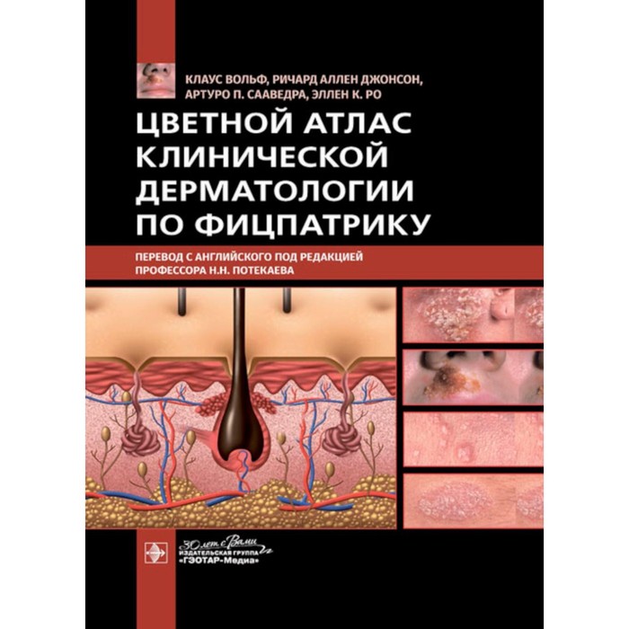 

Цветной атлас клинической дерматологии по Фицпатрику. Джонсон Р.А., Вольф К., Сааведра А.П., Ро Э.К.