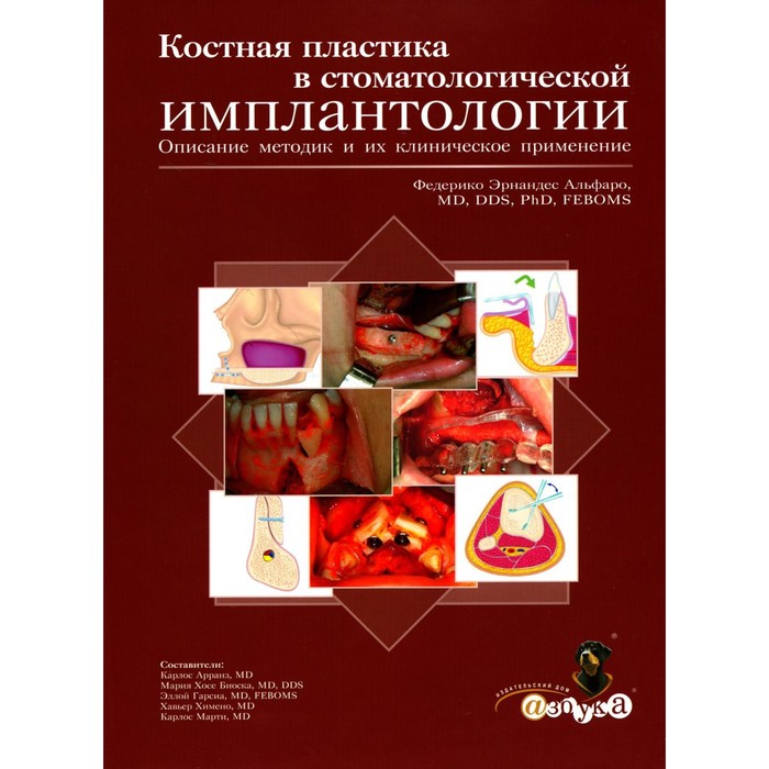 

Костная пластика в стоматологической имплантологии. Описание методик и их клиническое применение. Альфаро Ф.Э.