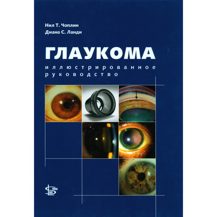 

Глаукома: иллюстрированное руководство. Чоплин Н.Т., Ланди Д.С.
