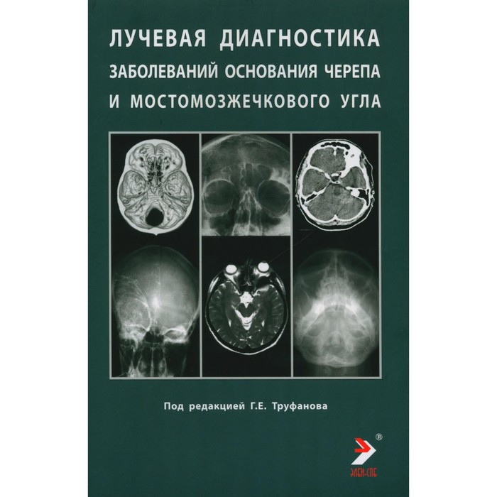 

Лучевая диагностика заболеваний оснований черепа и мостмозжечкового угла. Учебное пособие. Под ред. Труфанова Г.Е.